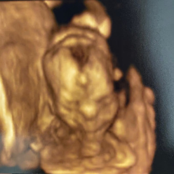 Babylist Registry Photo.