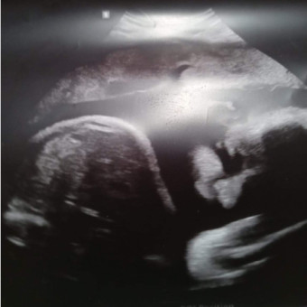 Babylist Registry Photo.