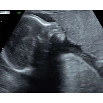 Babylist Registry Photo.