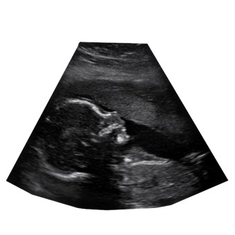 Babylist Registry Photo.