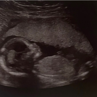 Babylist Registry Photo.