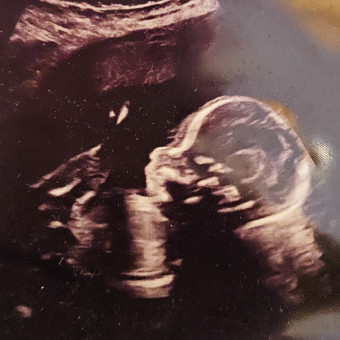 Babylist Registry Photo.