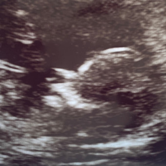 Babylist Registry Photo.
