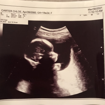 Babylist Registry Photo.
