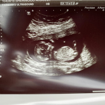 Babylist Registry Photo.