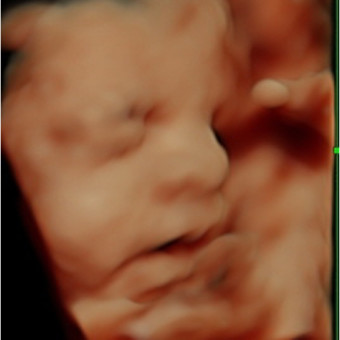 Babylist Registry Photo.