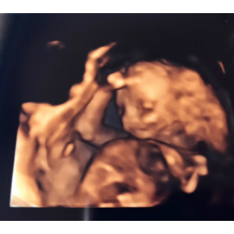 Babylist Registry Photo.