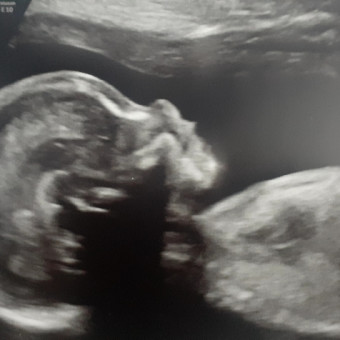 Babylist Registry Photo.