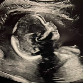 Babylist Registry Photo.