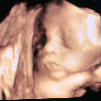Babylist Registry Photo.