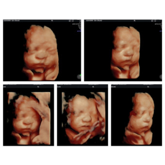 Babylist Registry Photo.