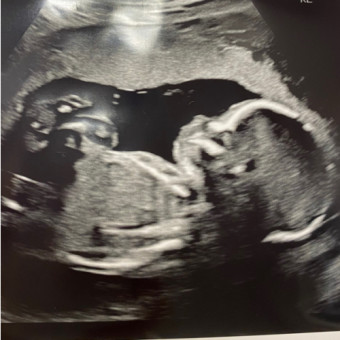 Babylist Registry Photo.