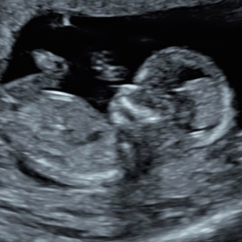 Babylist Registry Photo.