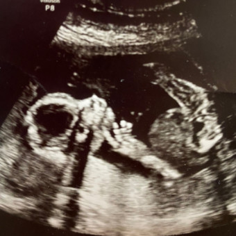 Babylist Registry Photo.