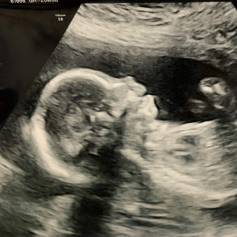 Babylist Registry Photo.