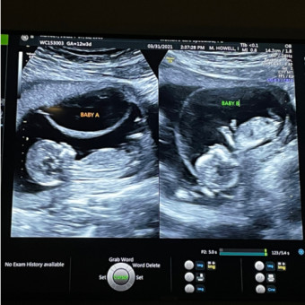 Babylist Registry Photo.