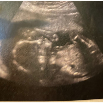 Babylist Registry Photo.