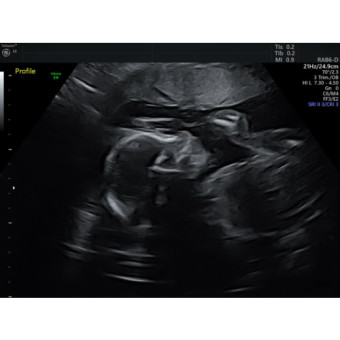 Babylist Registry Photo.