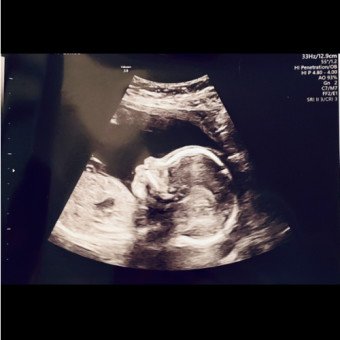 Babylist Registry Photo.