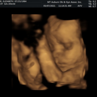 Babylist Registry Photo.