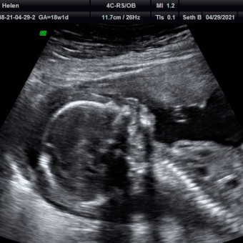 Babylist Registry Photo.