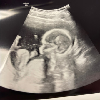 Babylist Registry Photo.