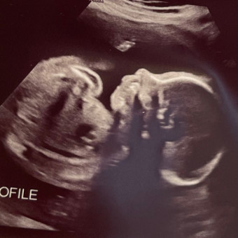 Babylist Registry Photo.