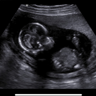 Babylist Registry Photo.