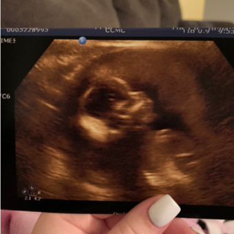 Babylist Registry Photo.