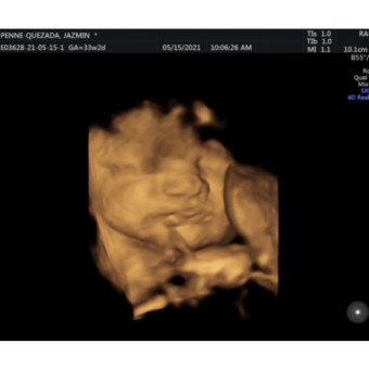 Babylist Registry Photo.