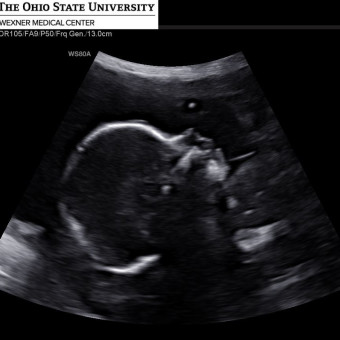 Babylist Registry Photo.