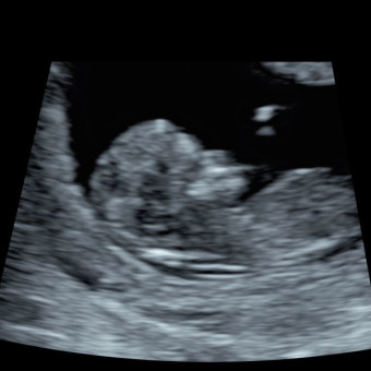 Babylist Registry Photo.