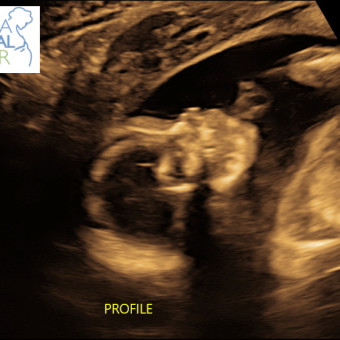 Babylist Registry Photo.