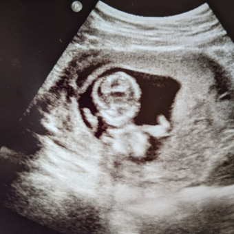 Babylist Registry Photo.