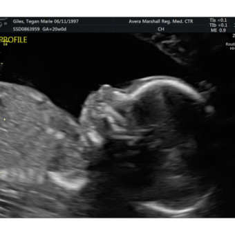 Babylist Registry Photo.