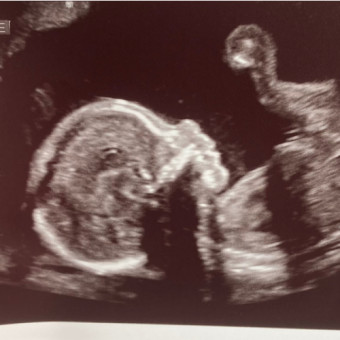 Babylist Registry Photo.