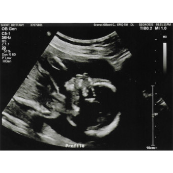 Babylist Registry Photo.