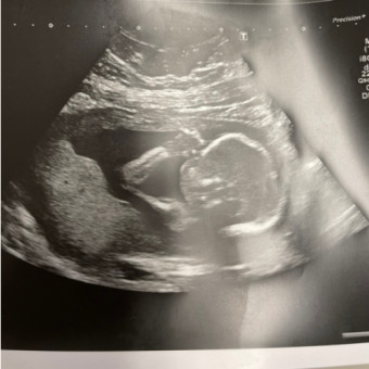Babylist Registry Photo.