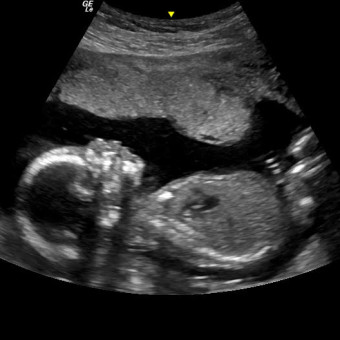 Babylist Registry Photo.