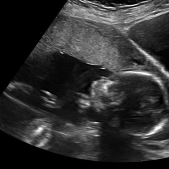 Babylist Registry Photo.