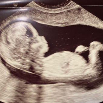 Babylist Registry Photo.