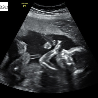 Babylist Registry Photo.