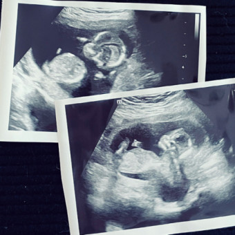 Babylist Registry Photo.