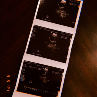 Babylist Registry Photo.