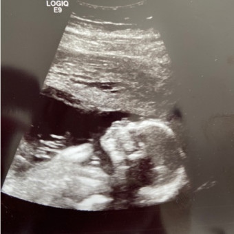 Babylist Registry Photo.