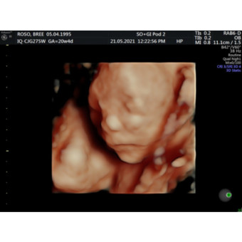 Babylist Registry Photo.