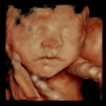 Babylist Registry Photo.