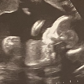 Babylist Registry Photo.