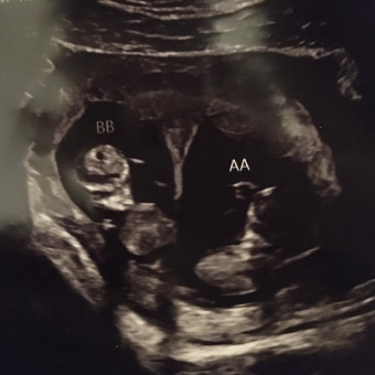 Babylist Registry Photo.