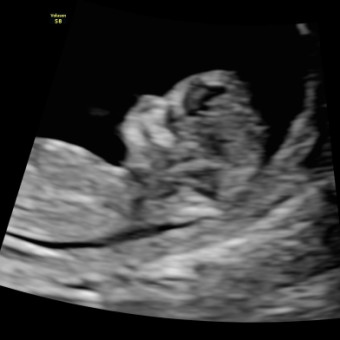 Babylist Registry Photo.